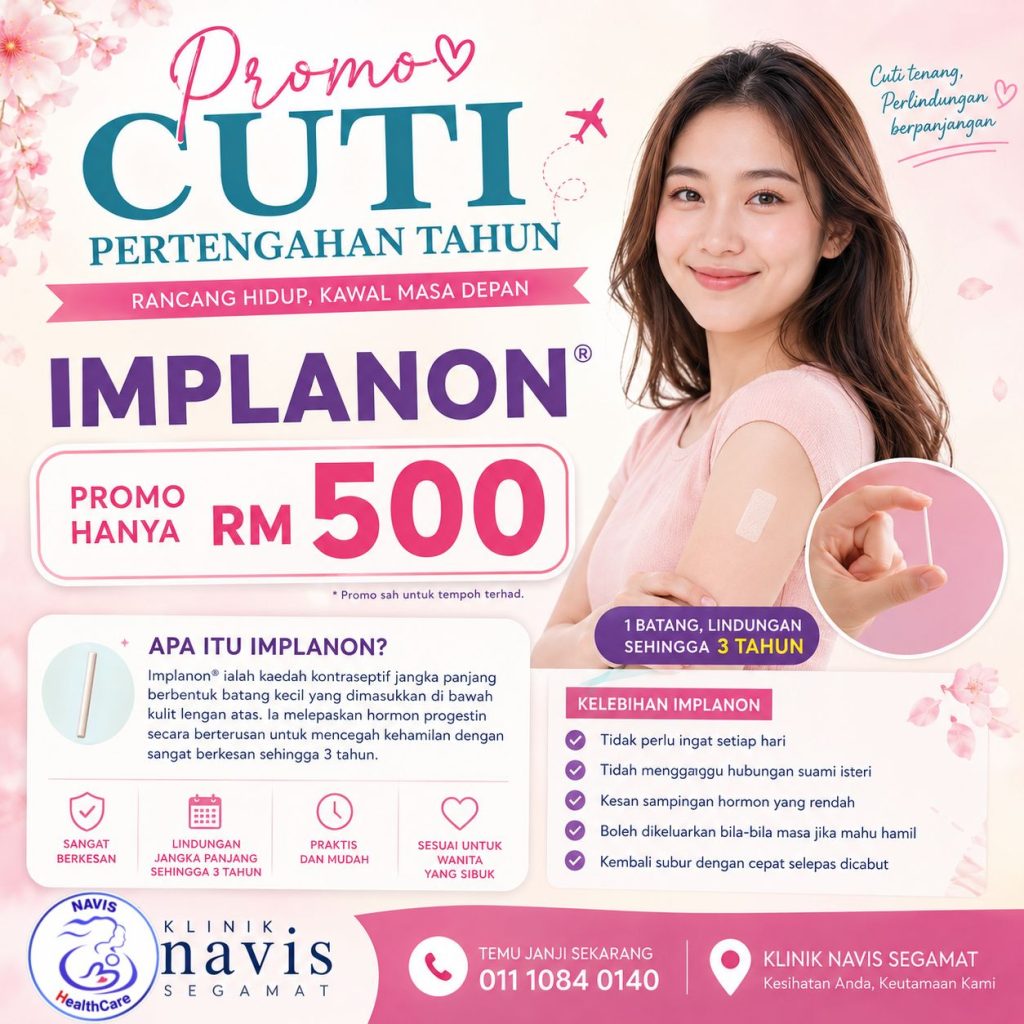 RM-500